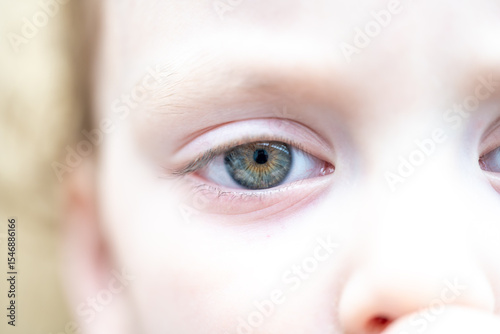 Right side of Human Child's Face with one Eye and a Blue Green Brown Colored Iris. Shot in Dayllight.
