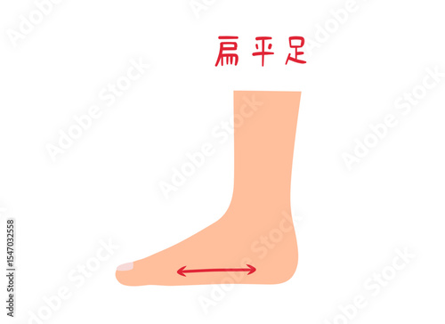 足裏のアーチがない偏平足のイラスト素材