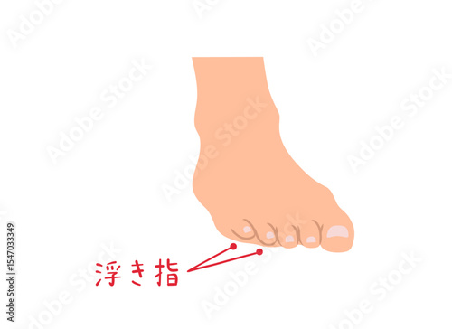 浮き指の主線なしシンプルイラスト素材