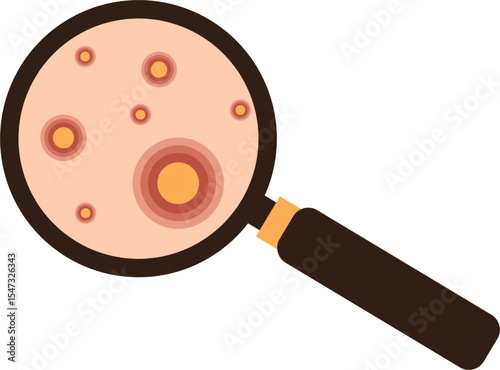 Skin Blemishes Under Magnifying Glass, Illustration of Acne, Pustules, and Inflammation.