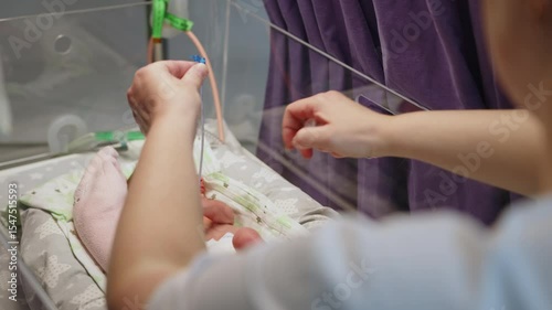 A premature baby in a neonatal intensive care unit receives nourishment from a syringe, donor breast milk. Showcasing the resource in a medical setting.