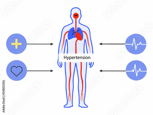 Flat medical illustration of human body with hypertension and blood flow system, heart health and treatment concept
