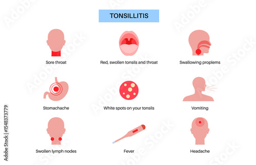Tonsillitis Oral Desease
