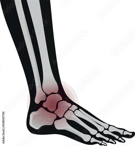 Human foot skeletal anatomy with highlighted ankle joint pain vector illustration 