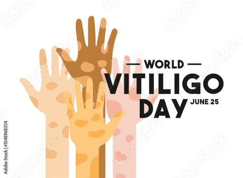 Flat design vector of World Vitiligo Day. June 25.