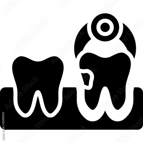 Tooth Extraction Icon