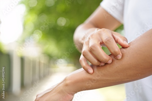 Person scratching itchy arm outdoors, skin irritation, allergy reaction, summer day
