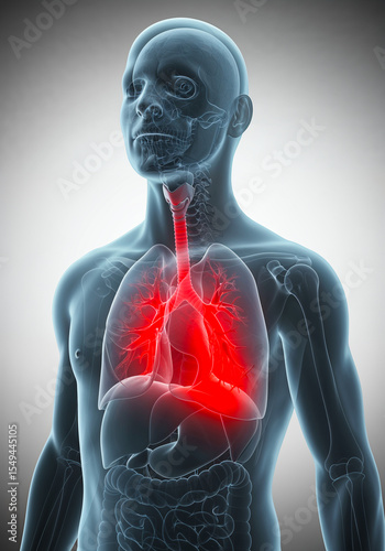 Human lungs anatomy showing asthma inflammation and bronchial constriction in 3D render