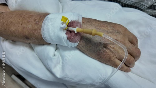 patient's hand with an IV needle inserted into it