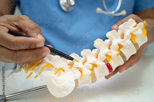 Asian doctor holding spinal nerve and bone model, Lumbar spine displaced herniated disc fragment for treatment medical in the orthopedic department.