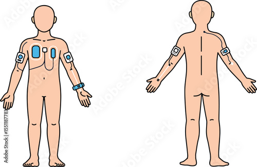 Child's Body with Medical Sensors Front and Back Views - Illustration
