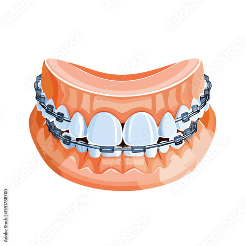 Orthodontic Braces on Teeth Vector Illustration