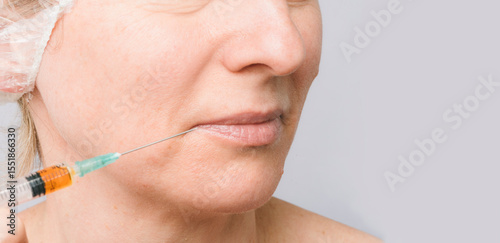 A woman at a skin care appointment with a cosmetologist with injections to rejuvenate and nourish the skin of her face and lips.