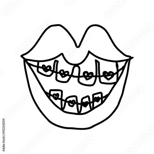 Smiling mouth with braces and heart shapes in fun doodle style for dental love campaigns, teenage self-love content, orthodontics humor illustrations, SVG vector with transparent background
