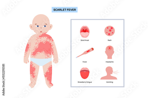 Scarlet fever poster