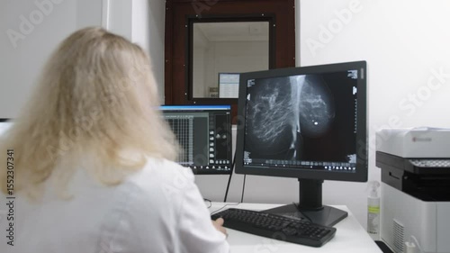 A doctor reviews a mammogram image on a computer screen, part of a breast cancer screening process. Mammogram Examination for Women