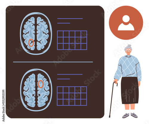 Brain scan comparison showing abnormalities with grid charts alongside an elderly woman holding a cane. Ideal for healthcare, aging, neurology, research, diagnostics, patient care, senior wellness. A