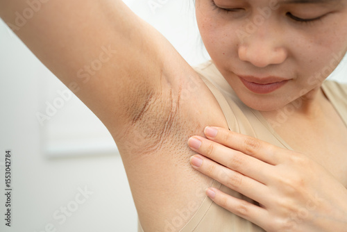 Asian woman have problem black armpit beauty skin care.