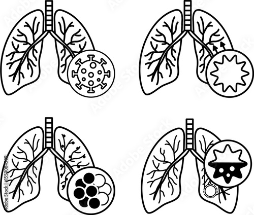 Icons of Lung Disease, Bronchitis, COPD, and Pneumonia. Vector Icons of Various Lung Diseases. Healthcare and Medicine