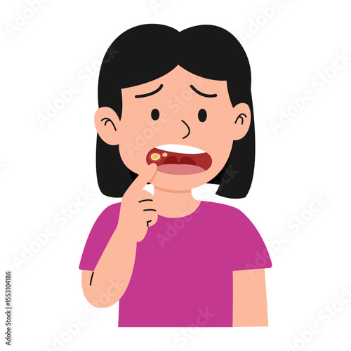 canker sore in mouth. vector illustration
