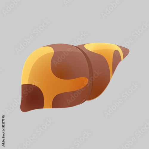 Cartoon concept for fatty liver disease or hepatic steatosis disease