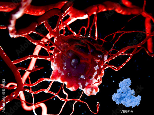 Growing tumor, angiogenic switch and neovascularization induced by VEGF-A