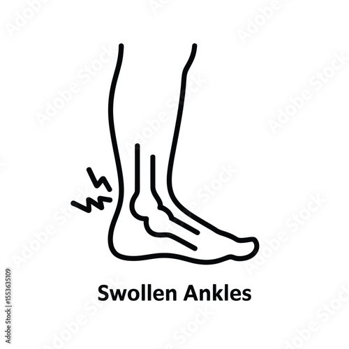 Simple line art illustration of a swollen ankle with pain symbols