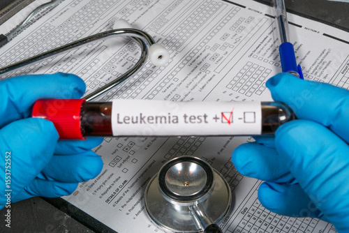 Doctor holding leukemia blood test with positive result