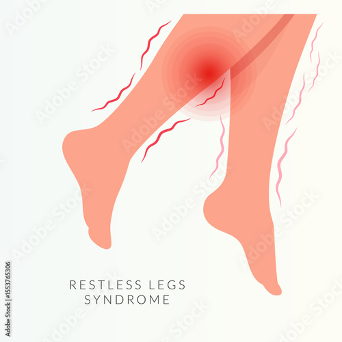 Restless Leg Syndrome - A Neurological Disorder  - Stock Illustration