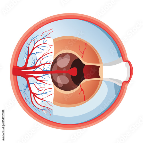 Eye Condition Disease Bleeding Medical Problem