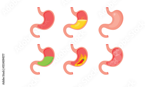 Human stomach