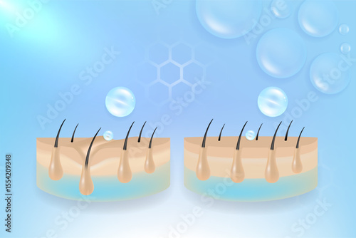 Hyaluronic acid and Niacinamide before and after hair and skin solutions ad, blue collagen serum drops into skin cell with cosmetic advertising background ready to use, illustration vector.