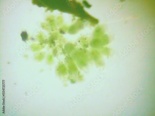 Rotifers  swimming in the water