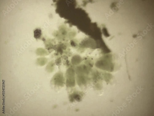 Rotifers  swimming in the water
