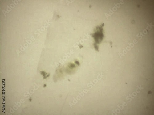 Rotifers  swimming in the water