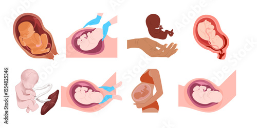 vector illustration of woman's pregnancy and child birth
