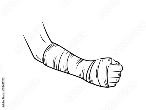 A black and white line drawing of a cast-wrapped arm and hand