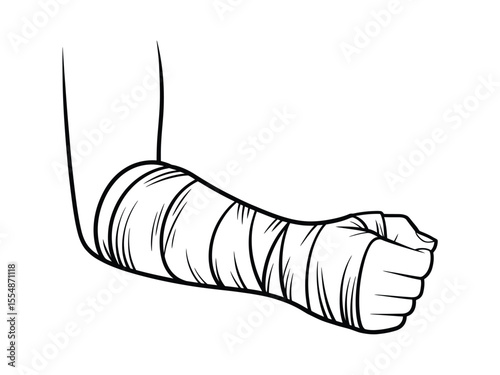 A black and white line drawing of a cast-wrapped arm and hand