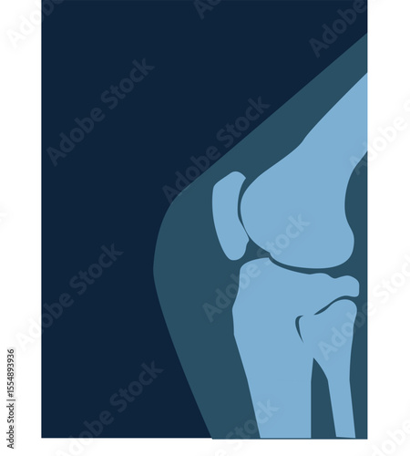  X ray image of the knee