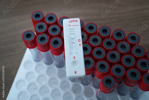 Blood sample of patient negative tested for leptospirosis by rapid diagnostic test on top of red vacuum tube.