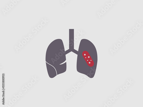 a pair of human lungs with one lung highlighted in red with circular spots