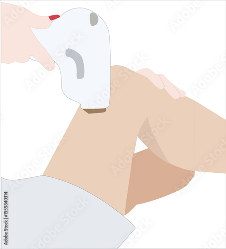 Laser Hair Removal Woman Legs. Laser epilation cosmetology procedure.