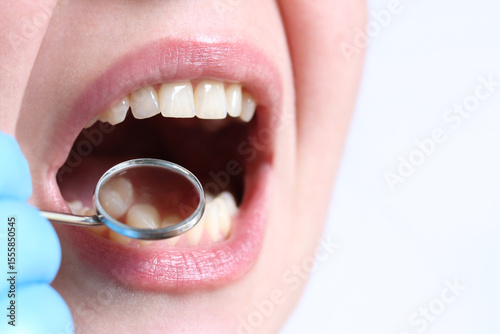 Smiling woman at the dentist, close-up. Dental mirror. Dentist examines patient's teeth with a dental mirror. Dentistry and oral hygiene concept. Real white teeth, not veneers. Close-up of teeth