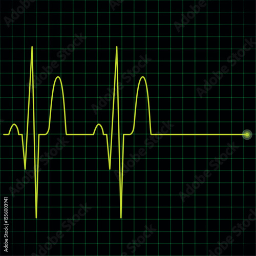 Electronic graph in yellow color