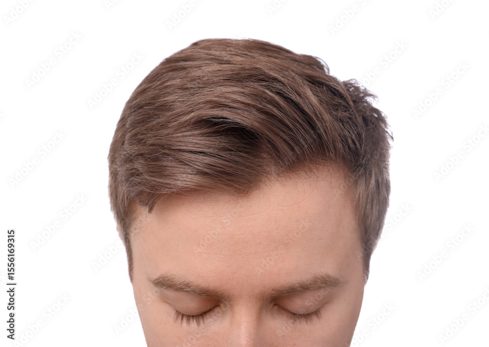 Fototapeta premium Man after hair loss treatment on white background, closeup