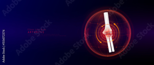 Red rotating arrow around elbow joint cartilage inflammation in dome on blue background. Arthritis and osteoarthritis. Human arm skeleton anatomy. Medical science concept. Vector EPS10.