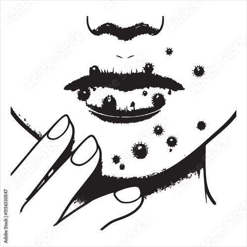 Herpes-affected lip silhouette showing distinct sores, simple black outline on a white background