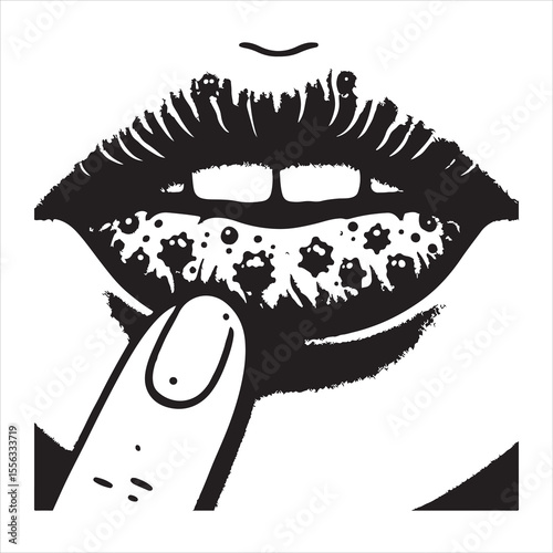 Herpes-affected lip silhouette showing distinct sores, simple black outline on a white background