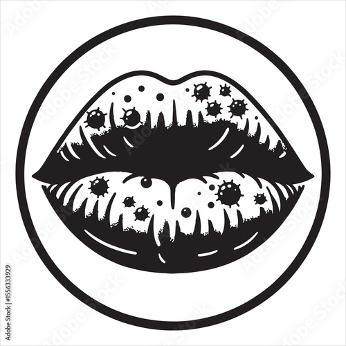 Herpes-affected lip silhouette showing distinct sores, simple black outline on a white background