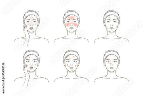 Woman's cosmetic skin trouble_Female character with freckle, blush, dryness, papule, pastule, blackhead